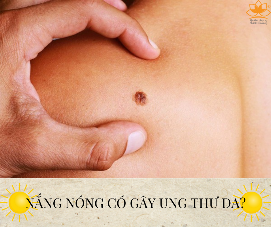 NẮNG NÓNG LIỆU CÓ GÂY UNG THƯ DA?